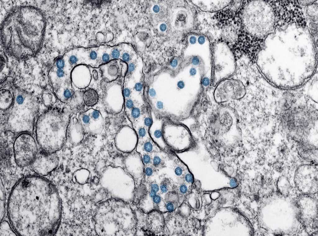 Ozdikenosis Disease